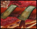 Organic Forms
